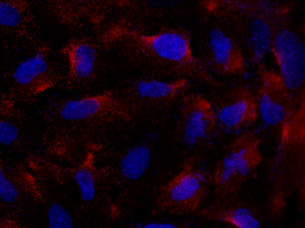 FcERI / FCER1A Antibody, Rabbit PAb, Antigen Affinity Purified, Immunofluorescence