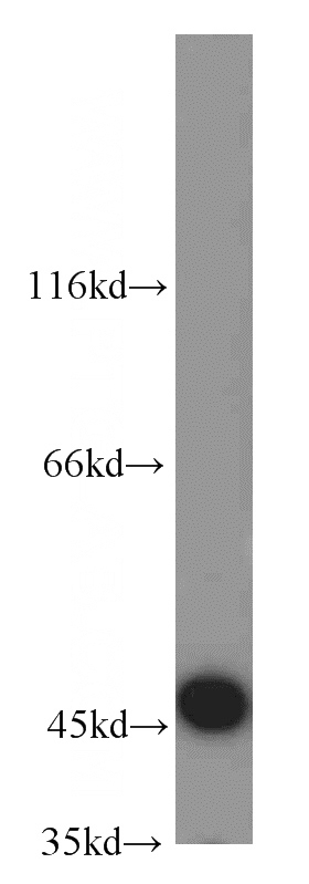 mouse testis tissue were subjected to SDS PAGE followed by western blot with Catalog No:109773(DDI1 antibody) at dilution of 1:1000