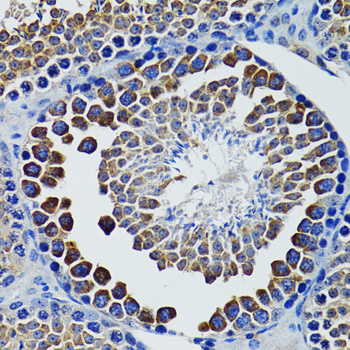 Immunohistochemistry - HEXA Polyclonal Antibody 