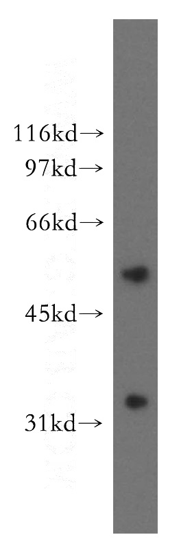 human liver tissue were subjected to SDS PAGE followed by western blot with Catalog No:107946(AKR7A3 antibody) at dilution of 1:400