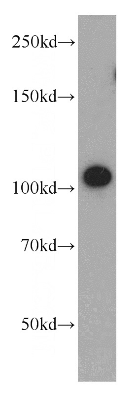 mouse brain tissue were subjected to SDS PAGE followed by western blot with Catalog No:115737(STRN antibody) at dilution of 1:500