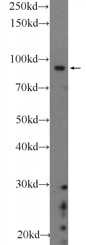 SH-SY5Y cells were subjected to SDS PAGE followed by western blot with Catalog No:108358(BARD1 Antibody) at dilution of 1:300
