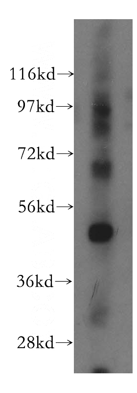 human brain tissue were subjected to SDS PAGE followed by western blot with Catalog No:109463(COPS3 antibody) at dilution of 1:500