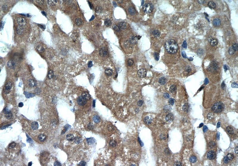 Immunohistochemistry of paraffin-embedded human liver tissue slide using Catalog No:111849(INSIG2 Antibody) at dilution of 1:50 (under 40x lens)