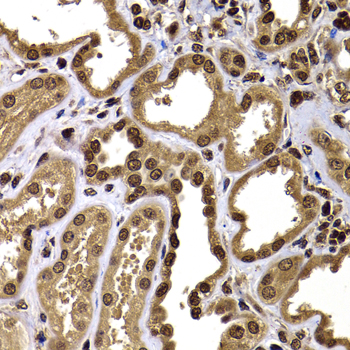 Immunohistochemistry - GPS1 Polyclonal Antibody 