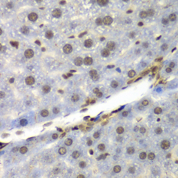 Immunohistochemistry - NELFE Polyclonal Antibody 