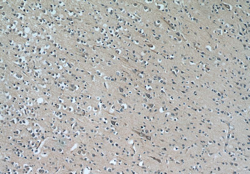 Immunohistochemistry of paraffin-embedded human brain tissue slide using Catalog No:109712(CYP7B1 Antibody) at dilution of 1:50 (under 10x lens)
