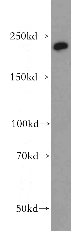 HeLa cells were subjected to SDS PAGE followed by western blot with Catalog No:109217(CHD1 antibody) at dilution of 1:500