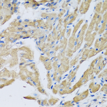 Immunohistochemistry - CRHBP Polyclonal Antibody 