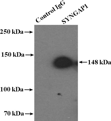 IP Result of anti-SYNGAP1 (IP:Catalog No:115783, 4ug; Detection:Catalog No:115783 1:500) with mouse brain tissue lysate 4000ug.