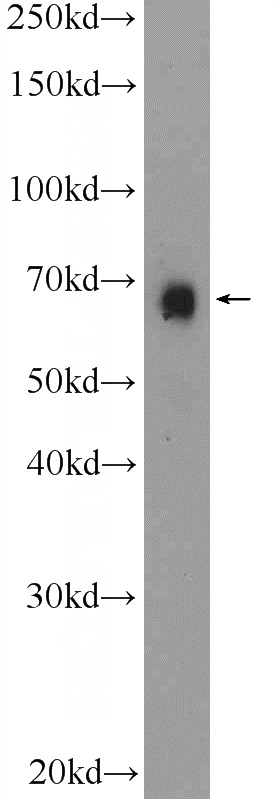 mouse kidney tissue were subjected to SDS PAGE followed by western blot with Catalog No:117209(BNIP3L Antibody) at dilution of 1:600