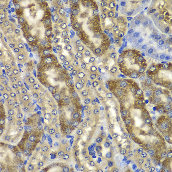 Immunohistochemistry - NMT2 Polyclonal Antibody 