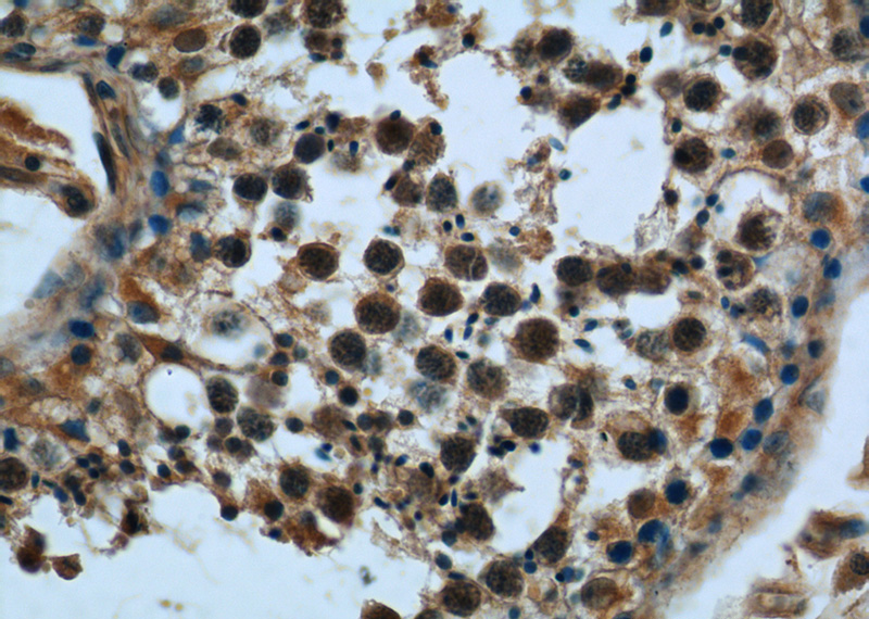 Immunohistochemistry of paraffin-embedded human testis tissue slide using Catalog No:112022(KDELC2 Antibody) at dilution of 1:50 (under 40x lens)