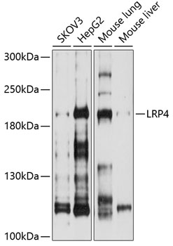 Western blot - LRP4 Polyclonal Antibody 