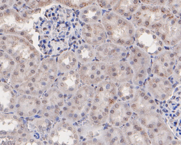Fig2:; Immunohistochemical analysis of paraffin-embedded rat kidney tissue using anti-MEOX2 antibody. The section was pre-treated using heat mediated antigen retrieval with sodium citrate buffer (pH 6.0) for 20 minutes. The tissues were blocked in 5% BSA for 30 minutes at room temperature, washed with ddH; 2; O and PBS, and then probed with the primary antibody ( 1/400) for 30 minutes at room temperature. The detection was performed using an HRP conjugated compact polymer system. DAB was used as the chromogen. Tissues were counterstained with hematoxylin and mounted with DPX.