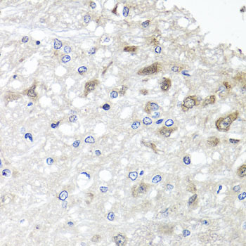 Immunohistochemistry - METTL20 Polyclonal Antibody 