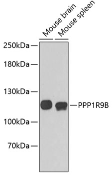 Western blot - PPP1R9B Polyclonal Antibody 