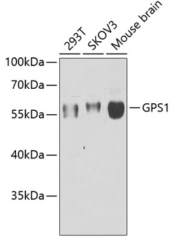Western blot - GPS1 Polyclonal Antibody 