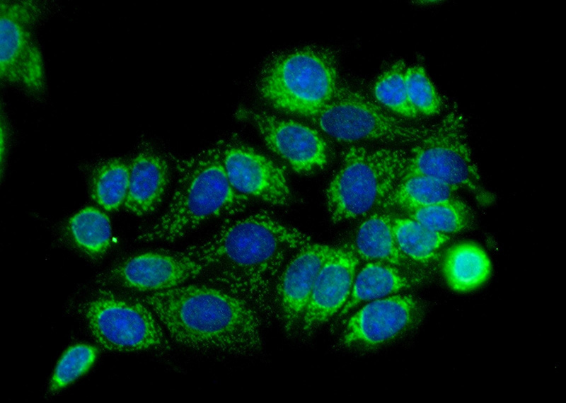 Immunofluorescent analysis of (-20oc Ethanol) fixed MCF-7 cells using Catalog No:115403(SMTNL2 Antibody) at dilution of 1:25 and Alexa Fluor 488-congugated AffiniPure Goat Anti-Rabbit IgG(H+L)