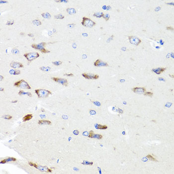 Immunohistochemistry - PIK3CA Polyclonal Antibody 