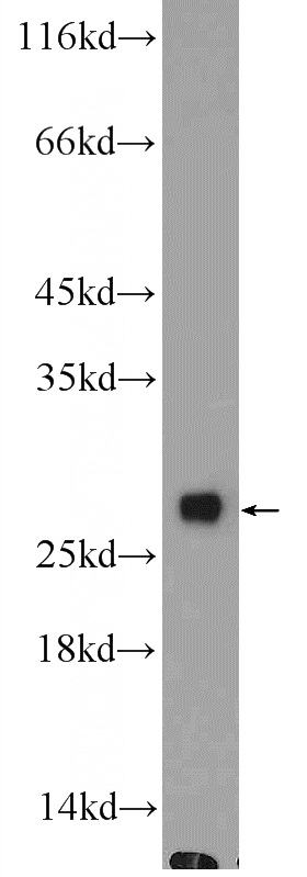 HL-60 cells were subjected to SDS PAGE followed by western blot with Catalog No:111157(GCA Antibody) at dilution of 1:600