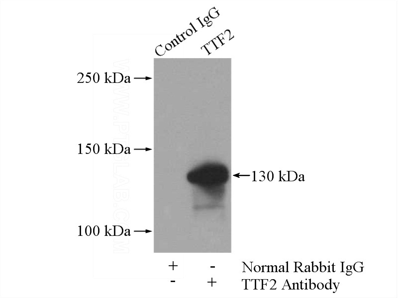 IP Result of anti-TTF2 (IP:Catalog No:116477, 4ug; Detection:Catalog No:116477 1:500) with A2780 cells lysate 840ug.