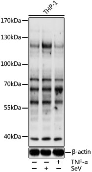 Western blot - Pan Phospho-Tyrosine mAb 