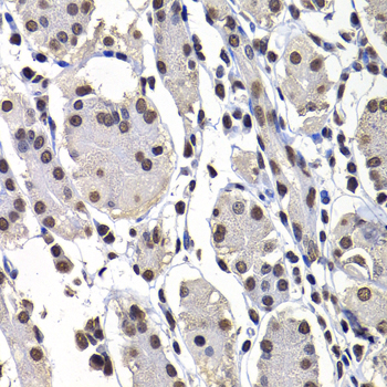 Immunohistochemistry - mH2A1 Polyclonal Antibody 