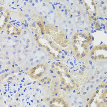 Immunohistochemistry - CTSC Polyclonal Antibody 