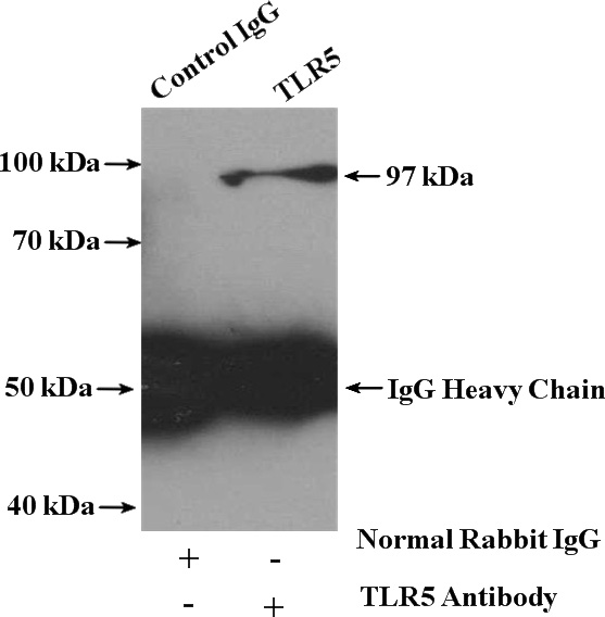 IP Result of anti-TLR5 (IP:Catalog No:116075, 4ug; Detection:Catalog No:116075 1:300) with HeLa cells lysate 4000ug.
