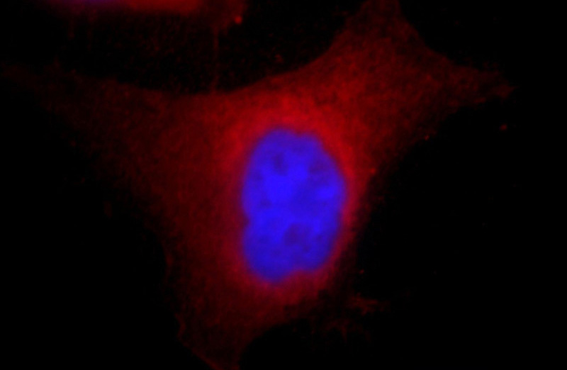 Immunofluorescent analysis of Hela cells, using AHCY antibody Catalog No: at 1:25 dilution and Rhodamine-labeled goat anti-mouse IgG (red). Blue pseudocolor = DAPI (fluorescent DNA dye).