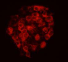 Fig2: ICC image of CELSR2 antibody stained D3 (Murine Embryonic Stem Cell Line).The secondary antibody (red) was goat anti-rabbit IgG (H+L) alexa555 conjugated.