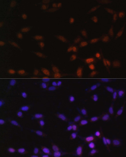 Immunofluorescence - ZEB2 Polyclonal Antibody 