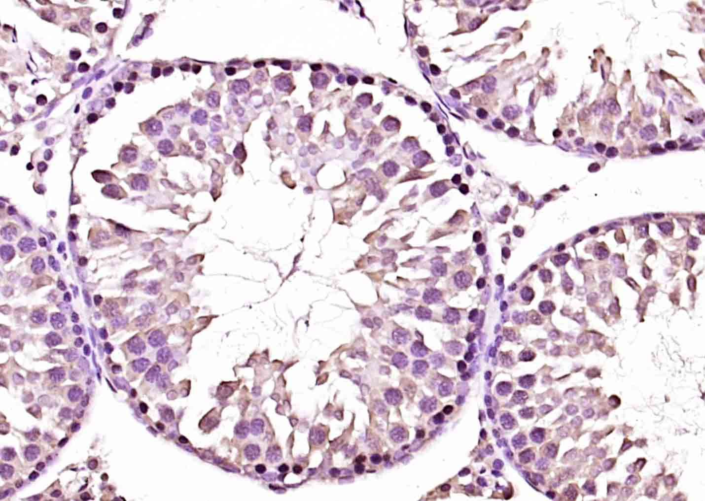 Fig1: Paraformaldehyde-fixed, paraffin embedded (rat testis tissue); Antigen retrieval by boiling in sodium citrate buffer (pH6.0) for 15min; Block endogenous peroxidase by 3% hydrogen peroxide for 20 minutes; Blocking buffer (normal goat serum) at 37℃ for 30min; Antibody incubation with (CITED1 ) Polyclonal Antibody, Unconjugated at 1:200 overnight at 4℃, followed by operating according to SP Kit(Rabbit) (sp-0023) instructionsand DAB staining.