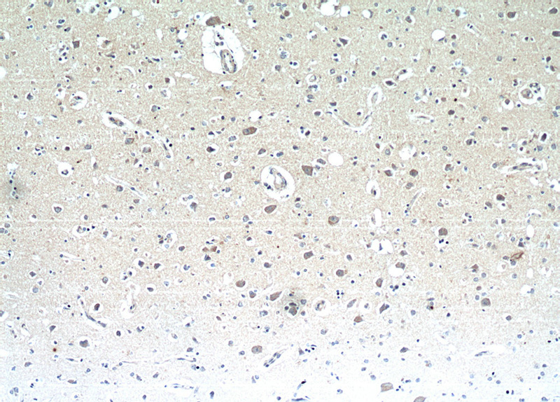 Immunohistochemical of paraffin-embedded human brain using Catalog No:113130(NMB antibody) at dilution of 1:25 (under 10x lens)