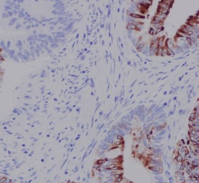 Immunohistochemical analysis of paraffin-embedded human colon, using N Cadherin Antibody.
