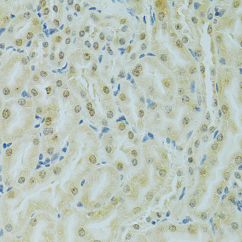 Immunohistochemistry - RCC1 Polyclonal Antibody 