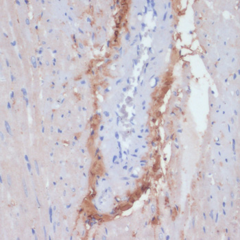 Immunohistochemistry - COL1A1 Polyclonal Antibody 