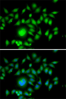 Immunofluorescence - ATOH1 Polyclonal Antibody 