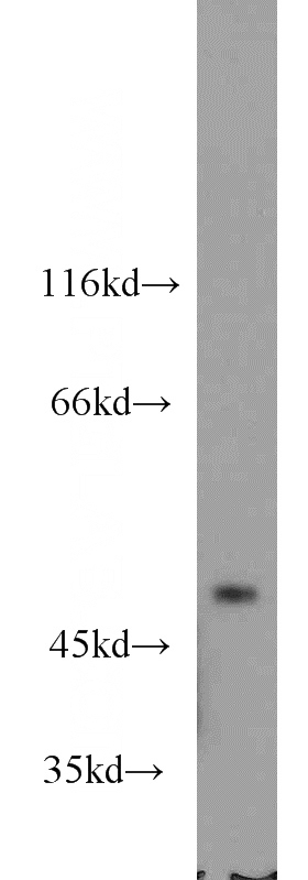 mouse cerebellum tissue were subjected to SDS PAGE followed by western blot with Catalog No:109239(CHN2 antibody) at dilution of 1:600