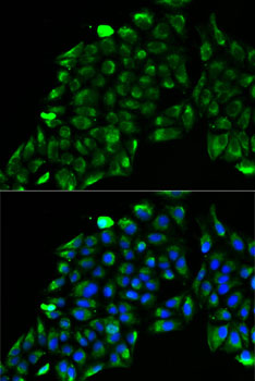 Immunofluorescence - ACADS Polyclonal Antibody 