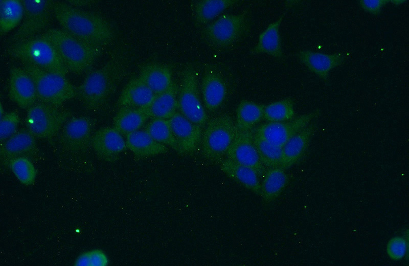 Immunofluorescent analysis of (-20oc Ethanol) fixed MCF-7 cells using Catalog No:113516(OTUD6A Antibody) at dilution of 1:50 and Alexa Fluor 488-congugated AffiniPure Goat Anti-Rabbit IgG(H+L)