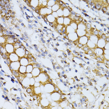 Immunohistochemistry - CCDC92 Polyclonal Antibody 