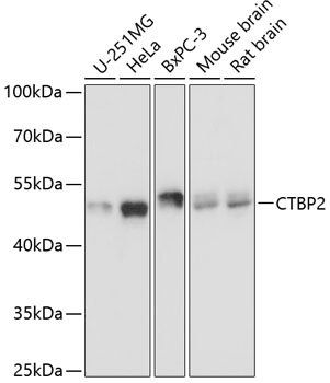 Western blot - CTBP2 Polyclonal Antibody 