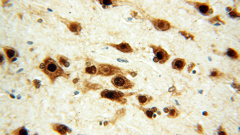 Immunohistochemical of paraffin-embedded human brain using Catalog No:110273(ELAVL2 antibody) at dilution of 1:100 (under 40x lens)