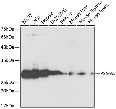 Western blot - PSMA5 Polyclonal Antibody 