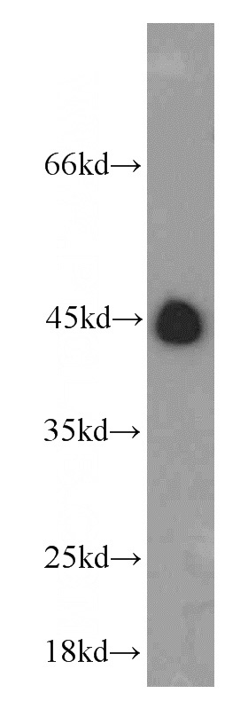 mouse lung tissue were subjected to SDS PAGE followed by western blot with Catalog No:114742(RNF150 antibody) at dilution of 1:500