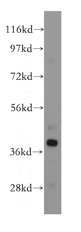 human liver tissue were subjected to SDS PAGE followed by western blot with Catalog No:114807(Noc2 antibody) at dilution of 1:500