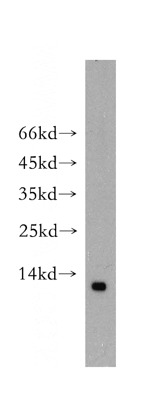 Apoptosised HeLa cells were subjected to SDS PAGE followed by western blot with Catalog No:115838(SUMO2/3 antibody) at dilution of 1:100