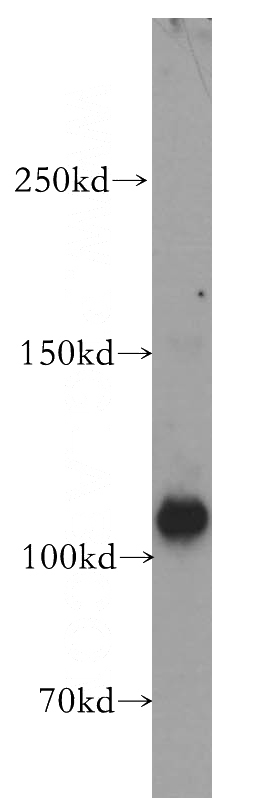 mouse brain tissue were subjected to SDS PAGE followed by western blot with Catalog No:110341(RAPGEF4 antibody) at dilution of 1:800